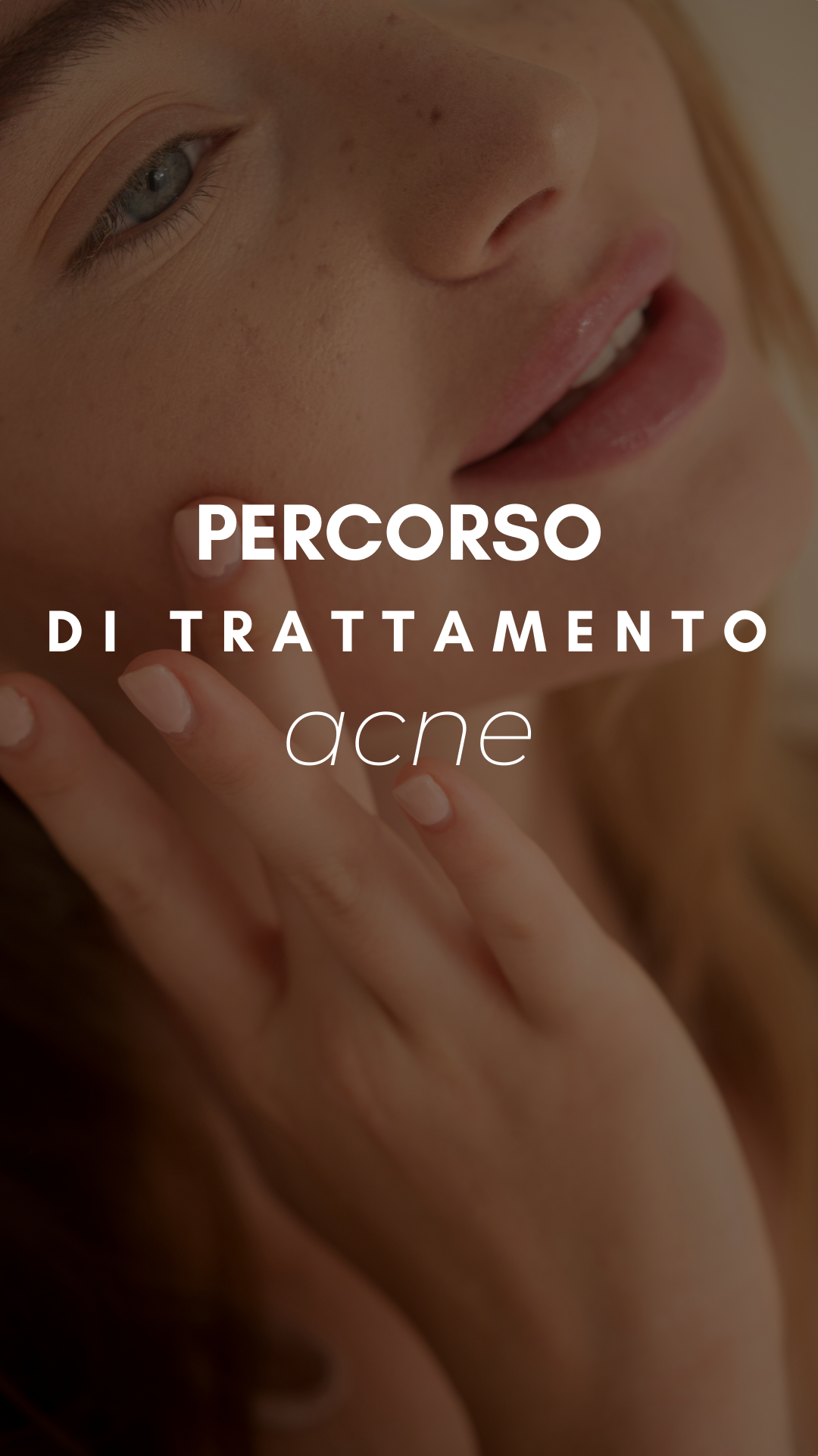 PERCORSO DI TRATTAMENTO ACNE